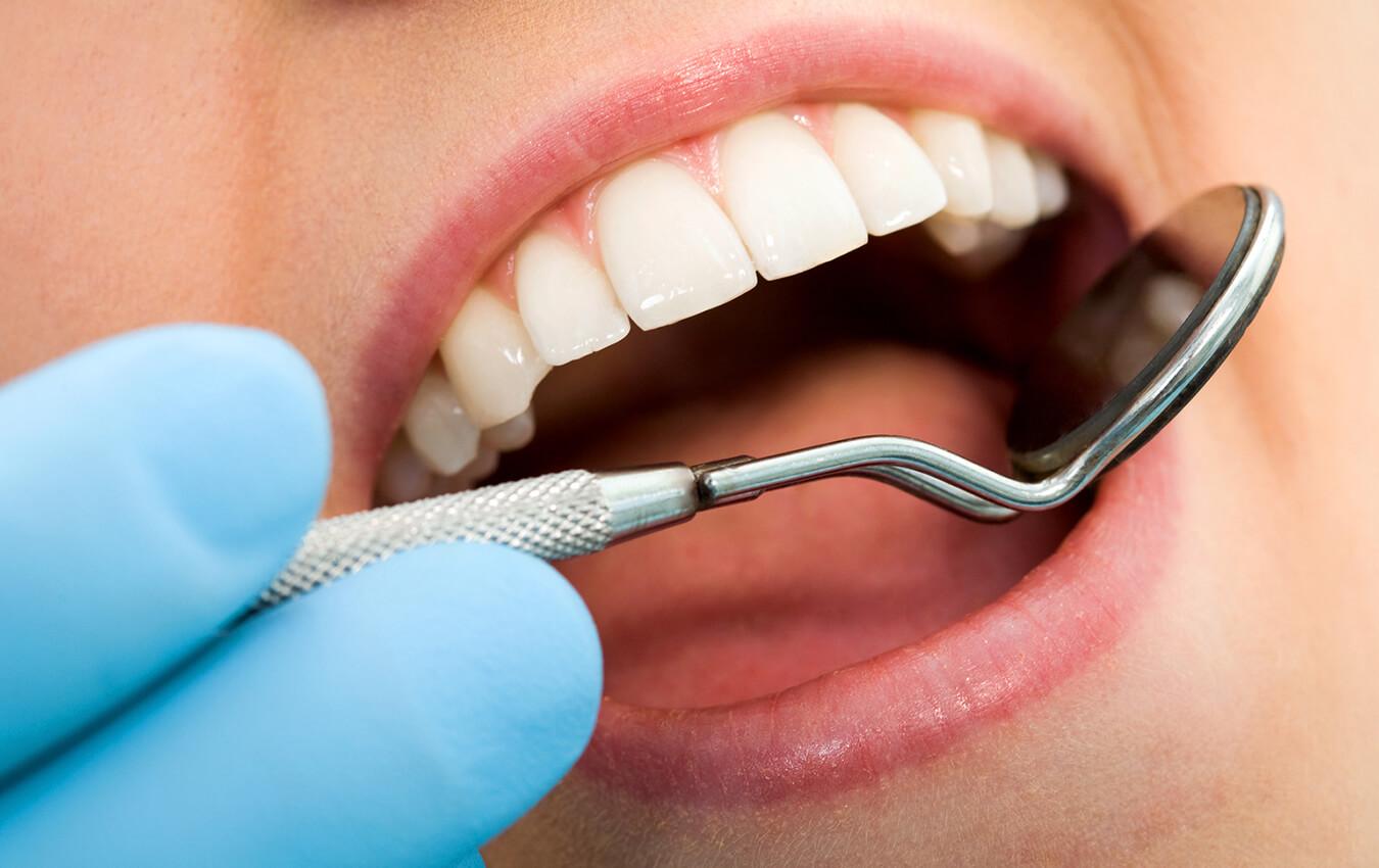 Beyond Aesthetics: How Braces Improve Oral Health and Boost Confidence